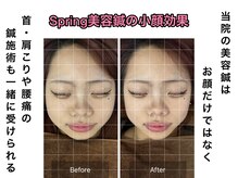 スプリング鍼灸院(Spring鍼灸院)/美容鍼なのに身体の鍼と整体も！