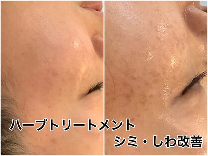 碧いしずくの写真