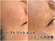 碧いしずくの写真