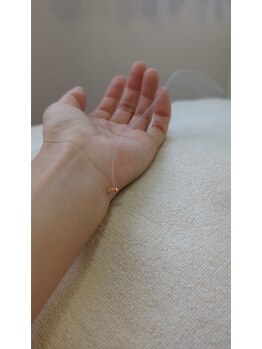 くらもちはり灸/養生moxibustion