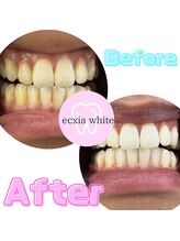 エクシアホワイト SOKA(ecxia white)/