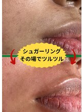 ディスイズミー シュガーリング(This is me Sugaring)/【シュガー】年齢問わず気になる