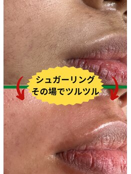 ディスイズミー シュガーリング(This is me Sugaring)/【シュガー】年齢問わず気になる