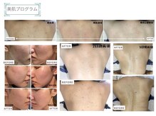 ベルスタイル(Bell style)/当店のお客様症例