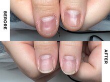 リミズネイルビューティー 名駅店(RimisNailxbeauty)の雰囲気（【深爪・噛み爪・凹凸】自然なフォルムに導く自爪風仕上げ）