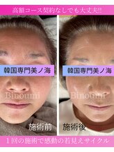 美ノ海/１回の施術!若見えサイクル復活!