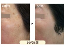 美男美女 奈良三条店/シミ改善専門