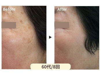 美男美女 奈良三条店/シミ改善専門