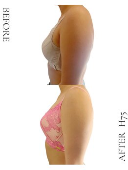 ビジュアルラボ(VISUAL LABO)/