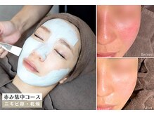 スリースリー 恵比寿(THREE THREE)の雰囲気（【原因別赤みケア」肌荒れ跡・繰り返す赤み・乾燥、短期集中ケア）