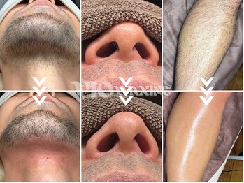 ヴィオワクシング(VIO WAXING)の写真/男性も安心の完全個室★気になるVIO（ブラジリアンワックス）や髭・ボディのムダ毛をスッキリ解消！