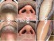 ヴィオワクシング(VIO WAXING)の写真/男性も安心の完全個室★気になるVIO（ブラジリアンワックス）や髭・ボディのムダ毛をスッキリ解消！