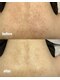 リルビー(Lilby)の写真/人目を気にせず通える、女性のためのプライベートサロン♪閑静な住宅街であなただけの美容時間を。