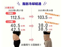 ココ(COCO)の雰囲気（結果の出る痩身／脂肪冷却）