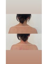 めい鍼灸院/姿勢矯正