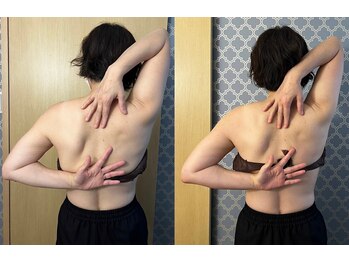 マイティー整骨院 ココア(CoCoa)/肩甲骨洗浄