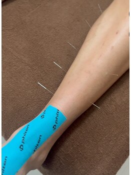 あゆみボディケア鍼灸整体院/鍼灸