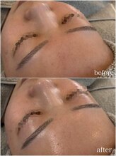 プレシア(Plecia)/ララピール＋LDM