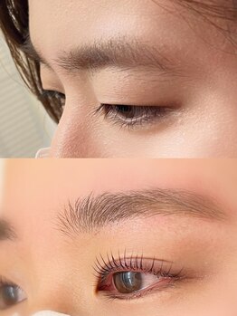 ミアン 名古屋(Mien)/before after