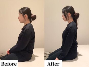 ソレア(Solea)/巻き肩・背中の張り・首こり改善