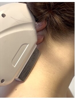 ウィローの写真/全身脱毛(顔・VIO込)ご新規様→9800円！安心の都度払いサロンで自分のペースで脱毛を続けられる♪