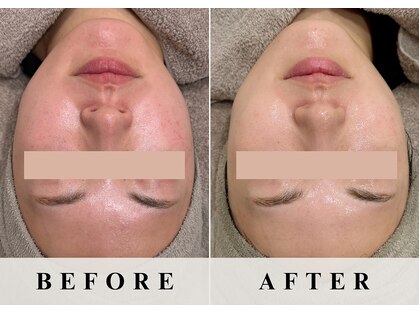 バーガルサロンギンザ(VAGAL SALON GINZA)の写真