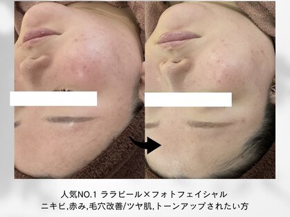 リリウム(Lilium)の写真