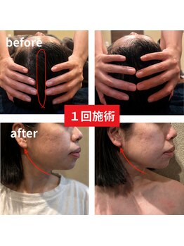 カナウ睡眠頭皮研究ラボ【7/3 NEW OPEN（予定）】の写真/ニホン人向けに改良された「痛気持ちいい」独自のコルギ小顔技術◎一時的ではない持続性の高い小顔を造形！