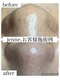 ジェンヌ(jenne.)の写真/当店お勧めNo.1【毛穴エクストラクション×エンビロン】¥8500~お悩み別エンビロン美容液導入コ-ス¥11800♪