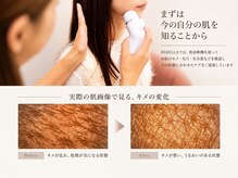リベラ(REBELLA)の雰囲気(肌診断・カウンセリング肌を見て必要なケアをご提案)