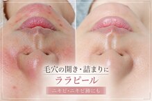 アオイ(Aoi)