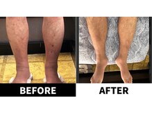 ありがとうパパの腸もみサロン アンド スクール/ビフォーアフター