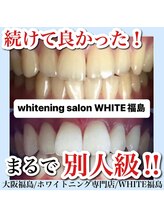 ホワイトニングサロン ホワイト(WHITE)/ホワイトニング/大阪/福島
