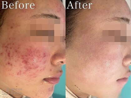 ライム 柏(LIME)の写真