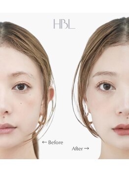 ジル 原店(JilL)/HBL/ハリウッドブロウリフト/原