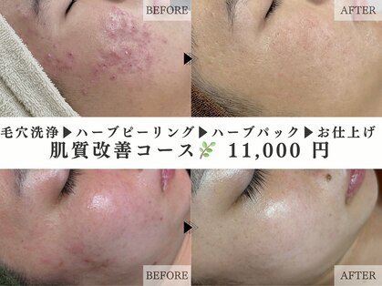 レヴェリー 心斎橋店(REVERIE)の写真