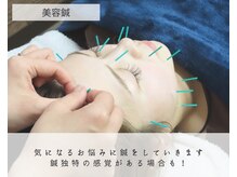 わきさか鍼灸整骨院・鍼灸院 レーヴ(Reve)/