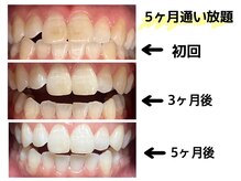 ベルーテエッセンスの雰囲気（ホワイトニングも人気のサロンでこの変化！！）