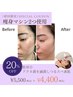 春の肌荒れニキビ・毛穴ケア殺菌&凹凸解消+美容液導入パック付☆30分¥5,500→