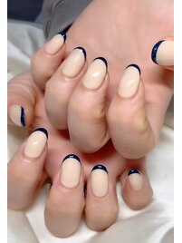 フレンチ☆フィルイン☆ケア