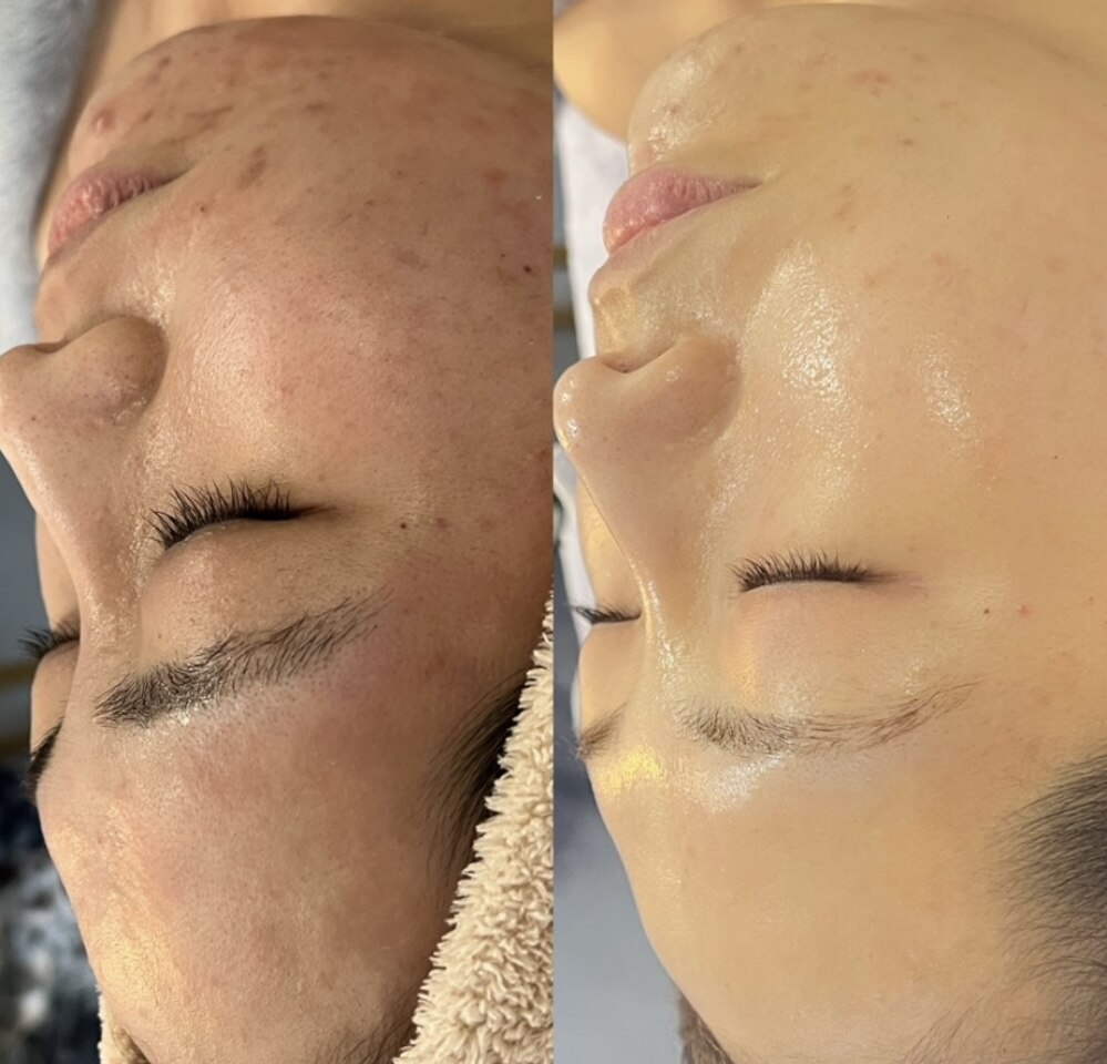 サロンムーン 赤坂(salon moon)｜ホットペッパービューティー