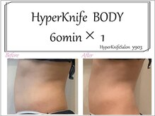 ワイキューマルサン(y903)/上半身60分×1回【ブライダル】