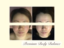 美プレミアム 越谷店/ １７、施術結果