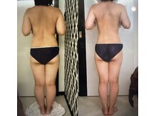 フェリーチェ(FELICE)/ビフォーアフター後ろ