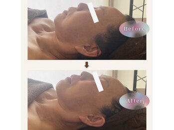 ジェイド(Jade)/初回のbefore→after