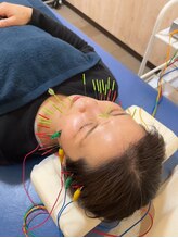 まごころ整骨院/即効性有り！電気美容鍼！