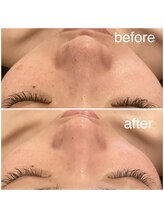 プール エドボリ(POOL EDOBORI)/頑固な黒ずみもスッキリ◎