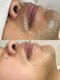 ジュエリー アンド ティアラ(Jewelry & Tiara)の写真/メンズ脱毛はデキる男の新常識！清潔感&第一印象UP！都度払いOK！人目を気にせず通えるプライベート空間！