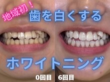 ハロ(halo)