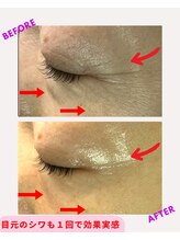 ユーフォリア(Euphoria)/目元のシワ改善にも効果的